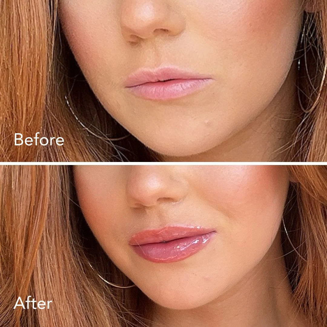 Plump Shot Lip Serum
